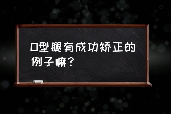 o型腿矫正5个有效方法 O型腿有成功矫正的例子嘛？