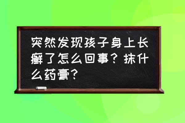 癣是什么原因引起的 突然发现孩子身上长癣了怎么回事？抹什么药膏？