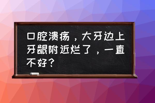 牙龈一直溃疡是怎么回事 口腔溃疡，大牙边上牙龈附近烂了，一直不好？