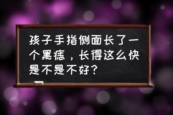 女人右手食指长痣好吗 孩子手指侧面长了一个黑痣，长得这么快是不是不好？