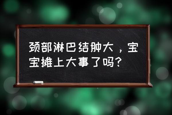 儿童淋巴结肿大需警惕 颈部淋巴结肿大，宝宝摊上大事了吗？