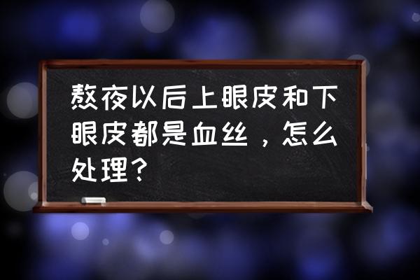 眼睛红血丝怎么快速消除 熬夜以后上眼皮和下眼皮都是血丝，怎么处理？